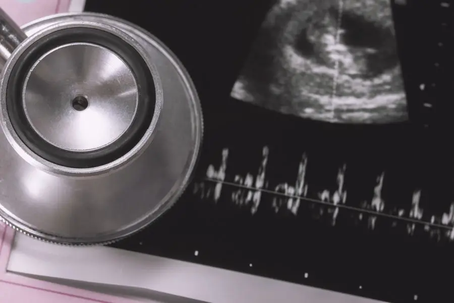 detektor tętna płodu – co to jest?